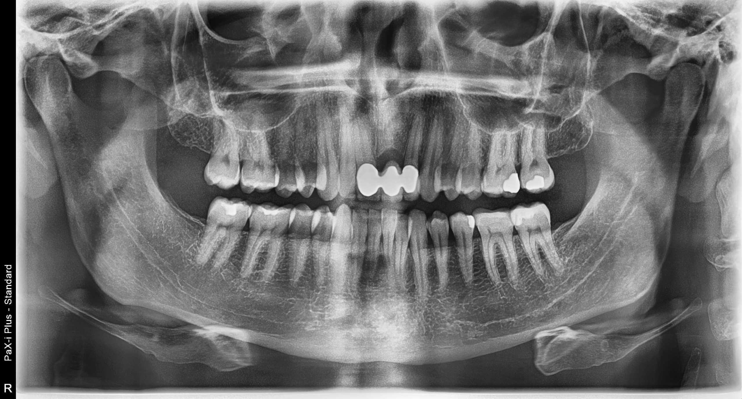 Room 1- Case 1 - My Ortho Board Prep