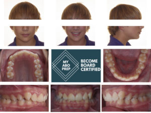 Board exam 1-Room 5- Case 1