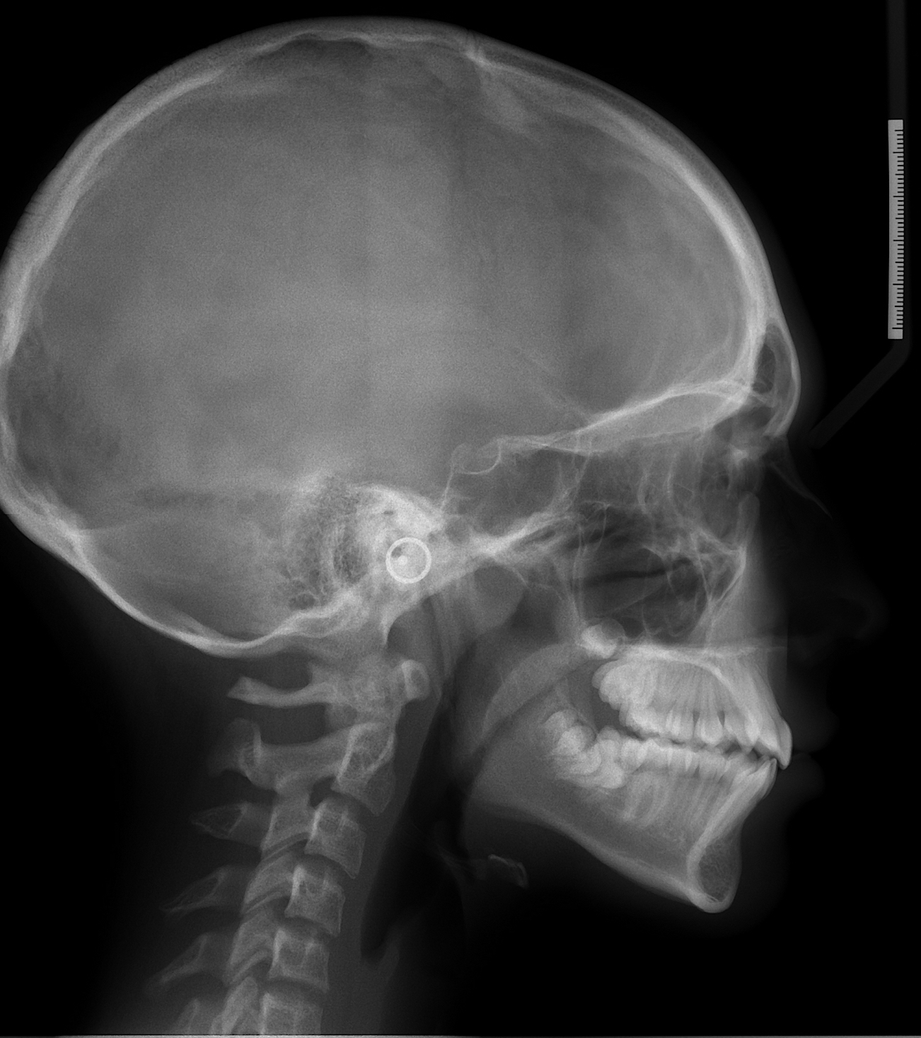 Exam 2- Room 3- Case 1 - My Ortho Board Prep