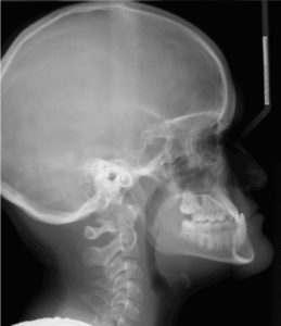 Exam 2- Room 3- Case 2
