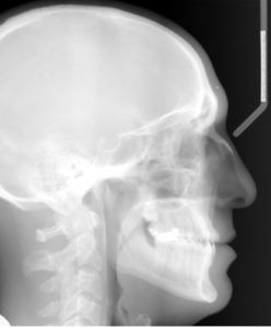 Exam 2- Room 2- Case 1