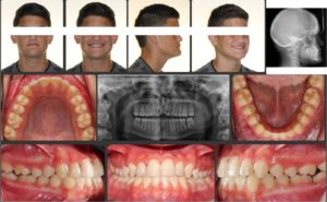 Exam 2- Room 3- Case 2.2