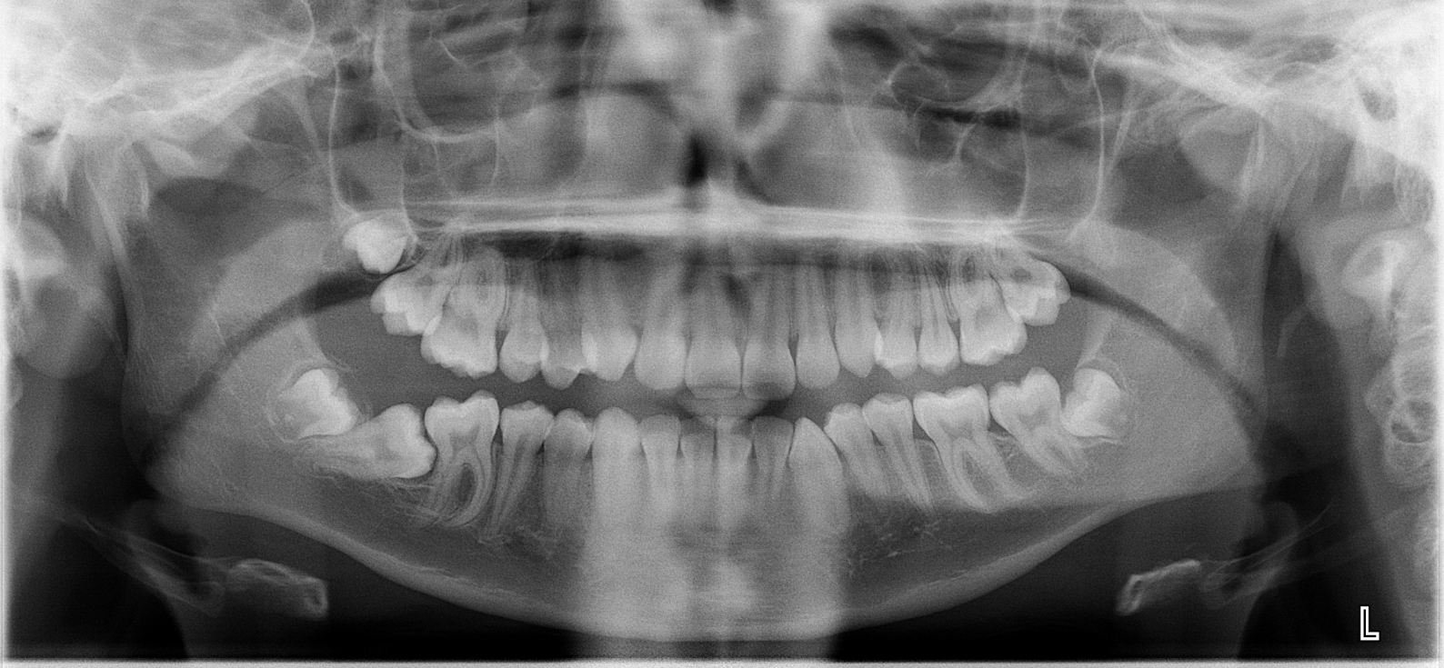 Exam 2- Room 3- Case 1 - My Ortho Board Prep