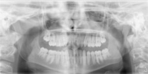 Exam 2- Room 3- Case 2