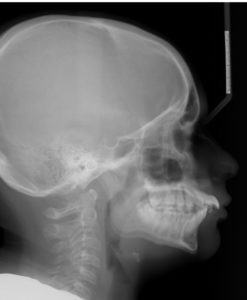 Exam 2-Room 1- Case 1