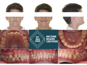 Exam 2- Room 3- Case 2