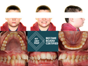 Exam 2-Room 1- Case 1