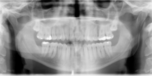 Exam 2- Room 2- Case 1