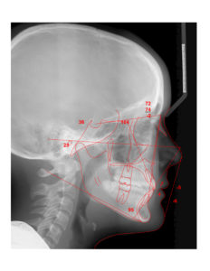 Exam 3- Room 5- Case 1.1