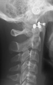 Exam 3- Room 2- Case 1