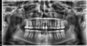 Exam 3- Room 3- Case 2