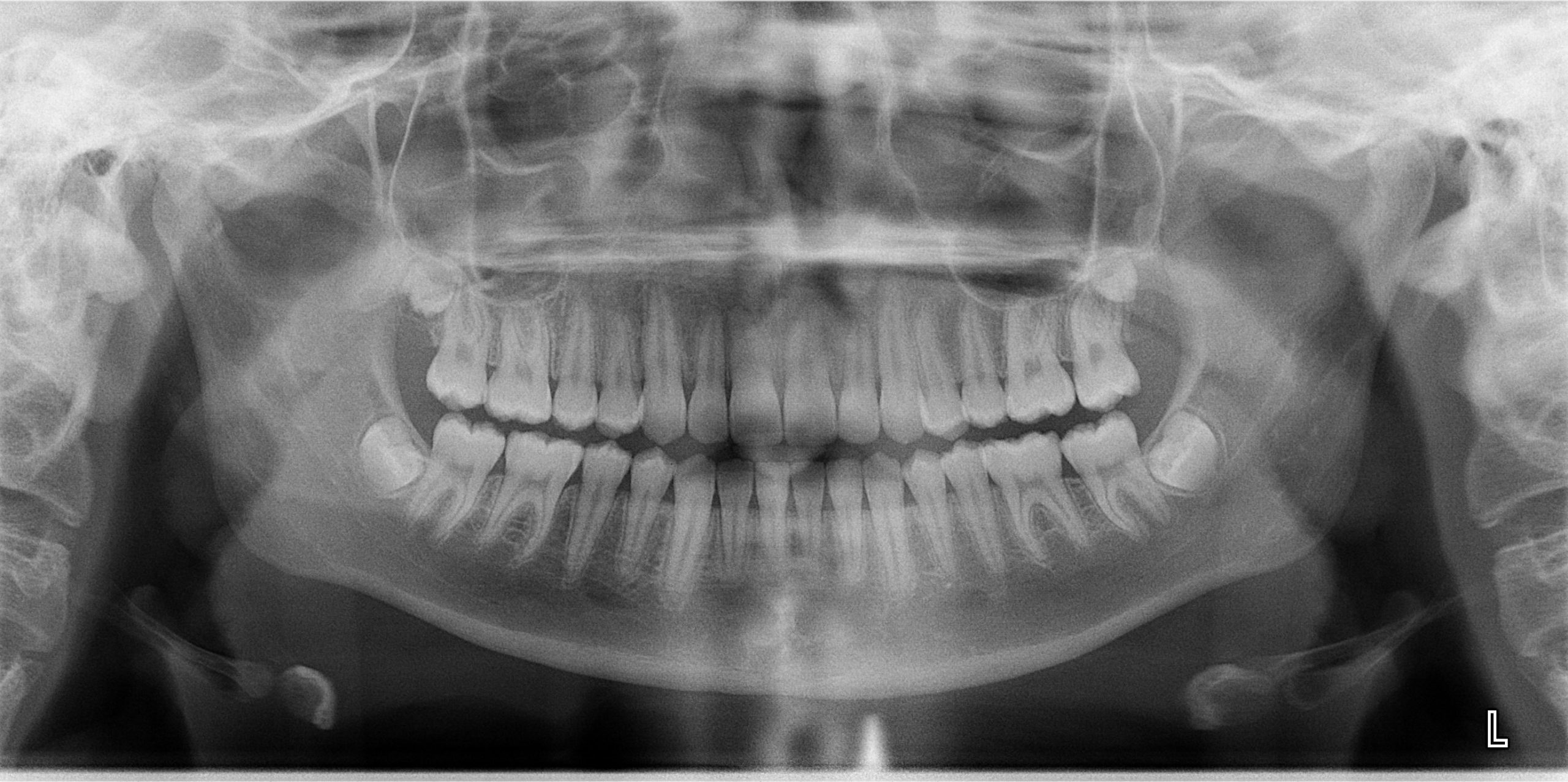 Exam 3- Room 5- Case 1.1 - My Ortho Board Prep