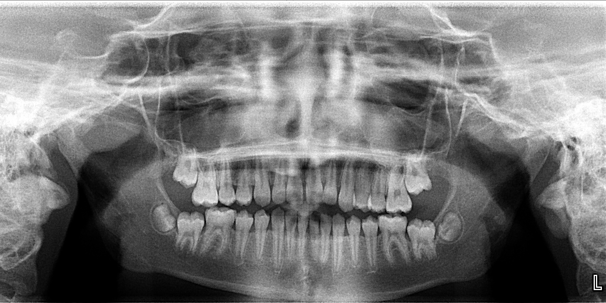 Exam 3-room 5- Case 1 - My Ortho Board Prep