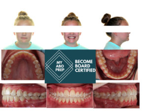 Exam 3- Room 5- Case 1.1