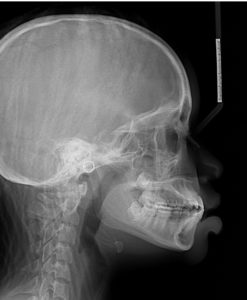 Exam 3- Room 4- Case 1