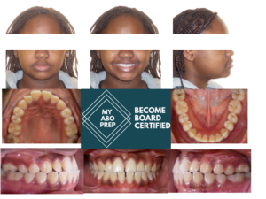 Exam 3- Room 4- Case 1