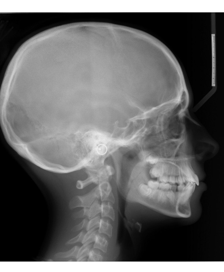 Exam 4-Room 1- Case 1.2 - My Ortho Board Prep