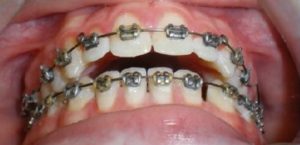 Exam 4- Room 5- Case 1.1