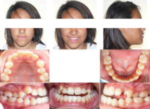 Exam 4- Room 2- Case 1