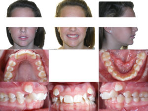 Exam 4- Room 3- Case 1