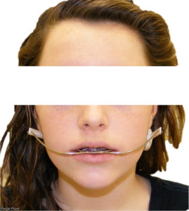 Exam 4- Room 3- Case 1.1