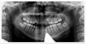 Exam 4- Room 2- Case 1