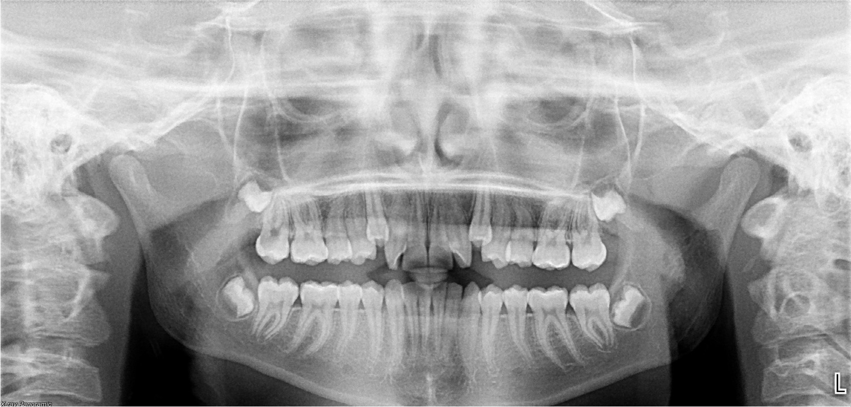 Exam 4- Room 3- Case 1 - My Ortho Board Prep