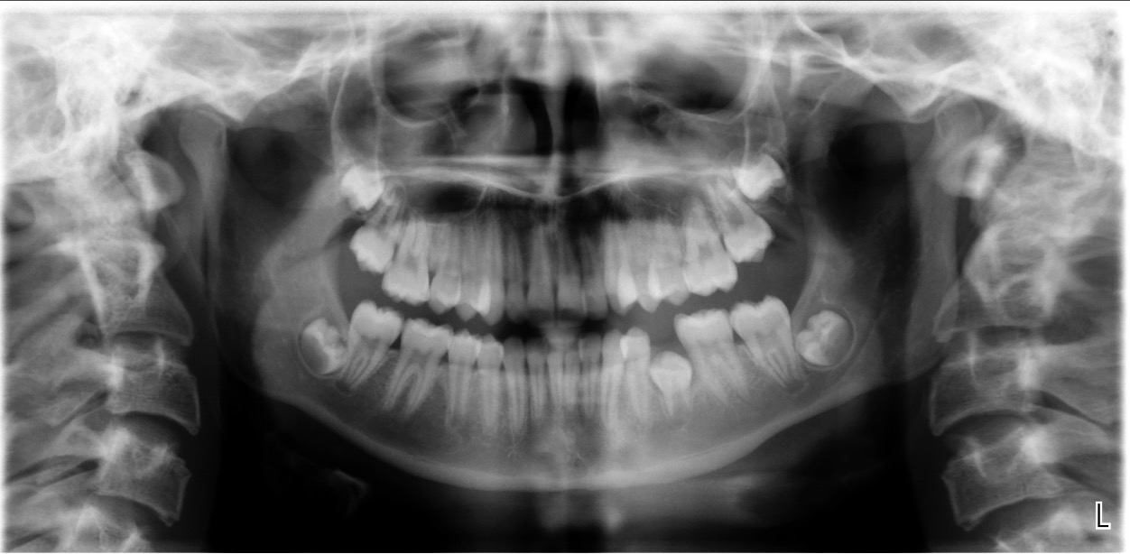 Exam 4-Room 1- Case 1 - My Ortho Board Prep