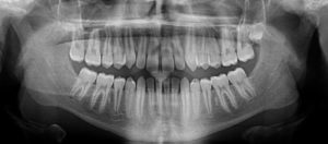 Exam 4- Room 5- Case 1