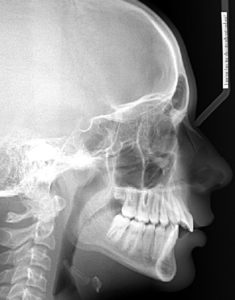 Exam 4- Room 5- Case 1