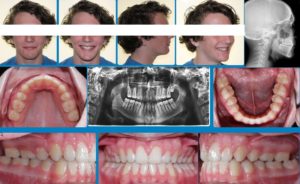 Exam 4- Room 5- Case 1.2
