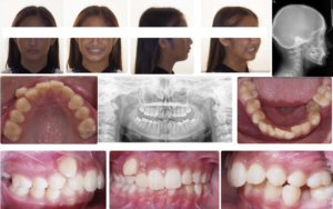 Exam 4- Room 4- Case 1