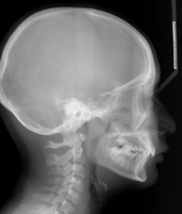 Exam 4- Room 4- Case 1
