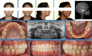 Exam 4- Room 4- Case 1.1