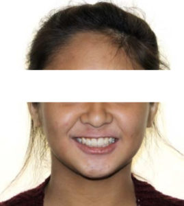 Exam 4- Room 4- Case 1.1