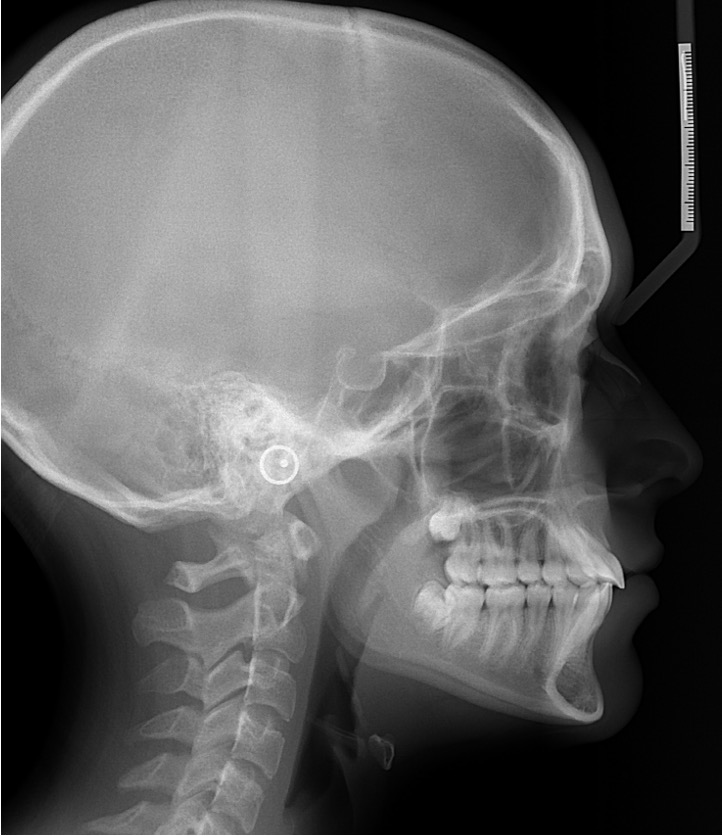 Exam 4- Room 3- Case 1.2 - My Ortho Board Prep