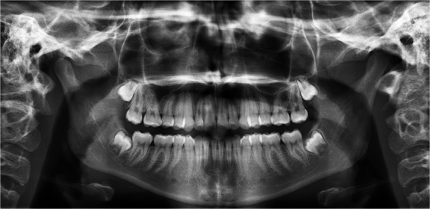 Exam 4- Room 3- Case 1.2 - My Ortho Board Prep