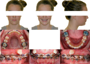Exam 4- Room 3- Case 1.1
